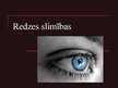 Prezentācija 'Redzes slimības', 1.
