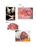 Konspekts 'Āda. Ādas slimības. Pirkstu nospiedumi', 6.