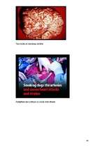 Referāts 'Atkarība no smēķēšanas', 44.