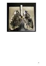 Referāts 'Atkarība no smēķēšanas', 46.