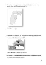 Referāts 'Karpālā kanāla sindroms', 9.