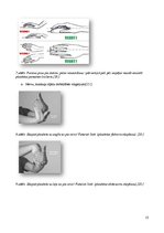 Referāts 'Karpālā kanāla sindroms', 12.