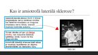 Prezentācija 'Amiotrofā laterālā skleroze', 2.