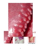 Konspekts 'Ginekoloģiskās infekcijas saslimšanas', 7.