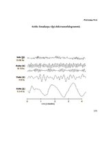 Diplomdarbs 'Miega traucējumi un to sekas', 36.