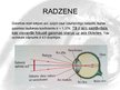 Prezentācija 'Cilvēka acs, redze, tās defekti', 3.