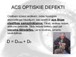 Prezentācija 'Cilvēka acs, redze, tās defekti', 10.