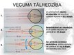 Prezentācija 'Cilvēka acs, redze, tās defekti', 11.