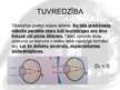 Prezentācija 'Cilvēka acs, redze, tās defekti', 13.