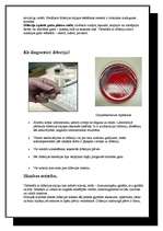 Referāts 'Difterija. Corynebacterium diphtherae', 4.
