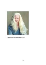 Referāts 'Albīnisms', 20.