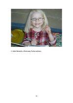 Referāts 'Albīnisms', 22.