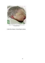 Referāts 'Albīnisms', 23.