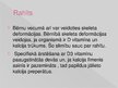 Prezentācija 'Skelets', 9.