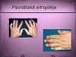 Prezentācija 'Psoriāze', 14.