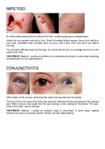 Konspekts 'Bacterial Infection', 2.