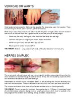 Konspekts 'Bacterial Infection', 3.