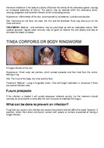 Konspekts 'Bacterial Infection', 7.