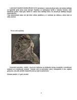 Referāts 'Hroniski obstruktīva plaušu slimība (HOPS)', 8.