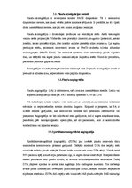 Referāts 'PATE - plaušu artēriju trombembolija', 14.