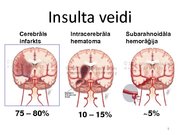 Prezentācija 'Insults. Smadzeņu infarkts', 5.