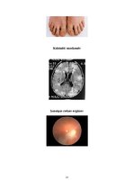 Referāts 'Ar tuberozo sklerozi slimojošu jauniešu iespējas apgūt amatu', 36.