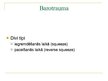 Prezentācija 'Barotrauma', 4.