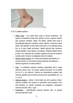 Referāts 'Izgulējumu profilakse un ārstēšana spinālajiem pacientiem', 15.