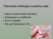 Prezentācija 'Manikīra ēnas puses', 4.
