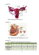 Diplomdarbs 'Informācijas trūkums sievietēm par dzemdes kakla vēzi', 58.