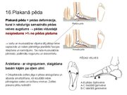 Prezentācija 'Sporta medicīna. Konspekts ieskaitei treneriem', 21.