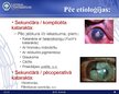 Prezentācija 'Katarakta', 9.