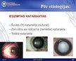 Prezentācija 'Katarakta', 13.
