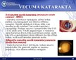 Prezentācija 'Katarakta', 18.