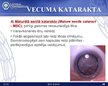 Prezentācija 'Katarakta', 19.