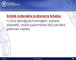 Prezentācija 'Katarakta', 26.
