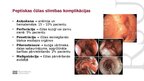Prezentācija 'Peptiska čūla', 5.