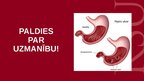 Prezentācija 'Peptiska čūla', 12.