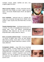 Konspekts 'Ādas slimības, kas skar sejas ādu', 2.