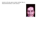 Konspekts 'Ādas slimības, kas skar sejas ādu', 9.