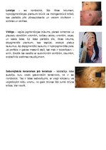 Konspekts 'Ādas slimības, kas skar sejas ādu', 12.