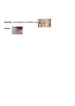 Konspekts 'Ādas slimības, kas skar sejas ādu', 14.