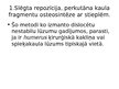 Prezentācija 'Kustību un balsta aparāta traumu konservatīvās un ķirurģiskās ārstēšanas metodes', 19.