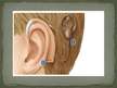 Prezentācija 'Dzirde, dzirdes implants', 5.
