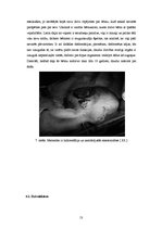 Referāts 'Černobiļas AES katastrofas ietekme', 13.