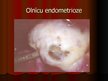 Prezentācija 'Endometrioze', 11.
