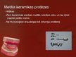 Prezentācija 'Zobu protezēšana', 8.