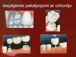 Prezentācija 'Zobu protezēšana', 11.