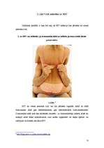 Referāts 'Cīņa ar HIV un AIDS 20. un 21.gadsimtā', 10.