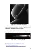 Referāts 'Cīņa ar HIV un AIDS 20. un 21.gadsimtā', 13.